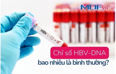Chỉ số HBV DNA bao nhiêu là bình thường?