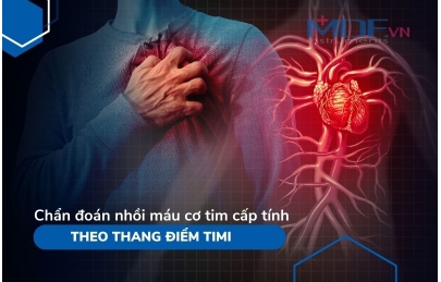 Chẩn đoán nhồi máu cơ tim cấp tính theo thang điểm timi