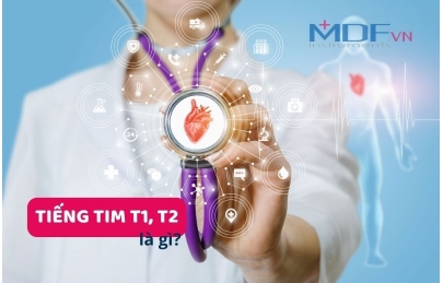 Tiếng tim T1 T2 là gì? Khi nào nghe được tiếng tim tách đôi