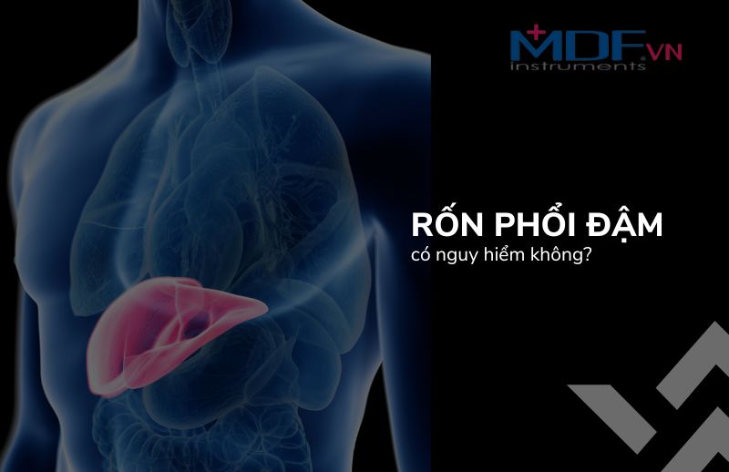 Rốn phổi đậm là gì? Có nguy hiểm không?